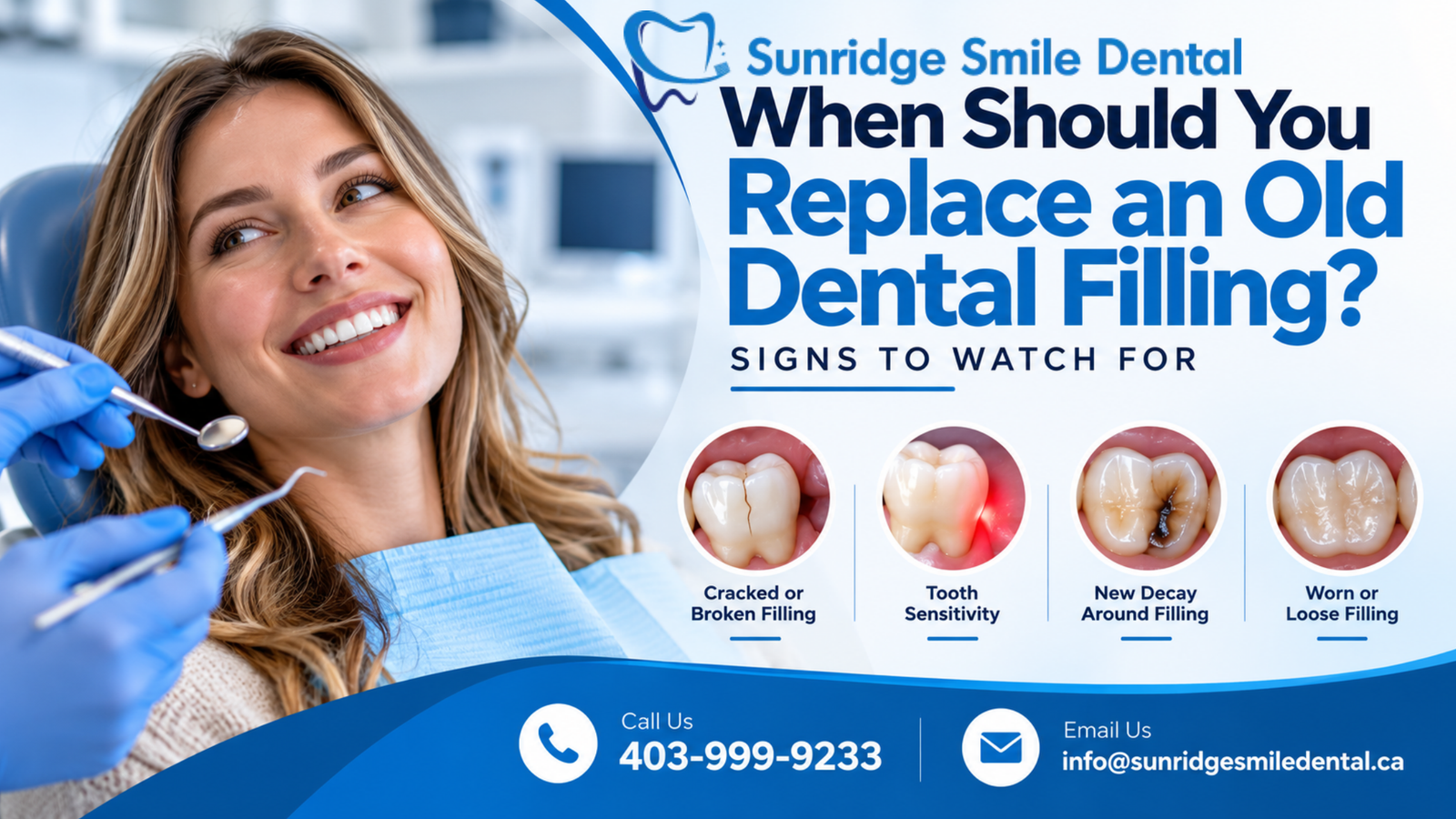 Wondering if you need to replace an old dental filling? Learn the signs of a failing filling and when to see a dentist in Sunridge.
