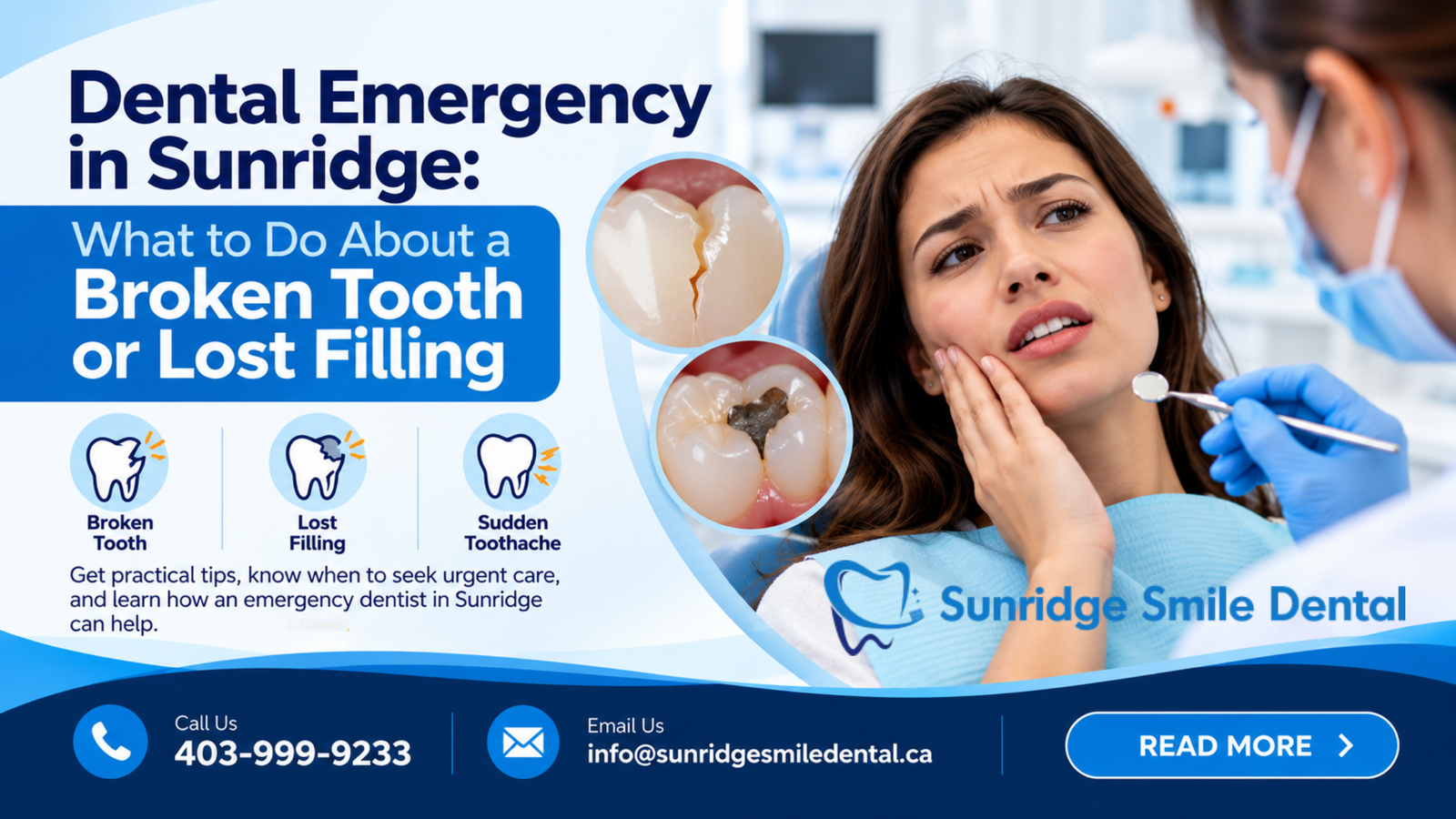Dental Emergency in Sunridge: What to Do About a Broken Tooth or Lost Filling